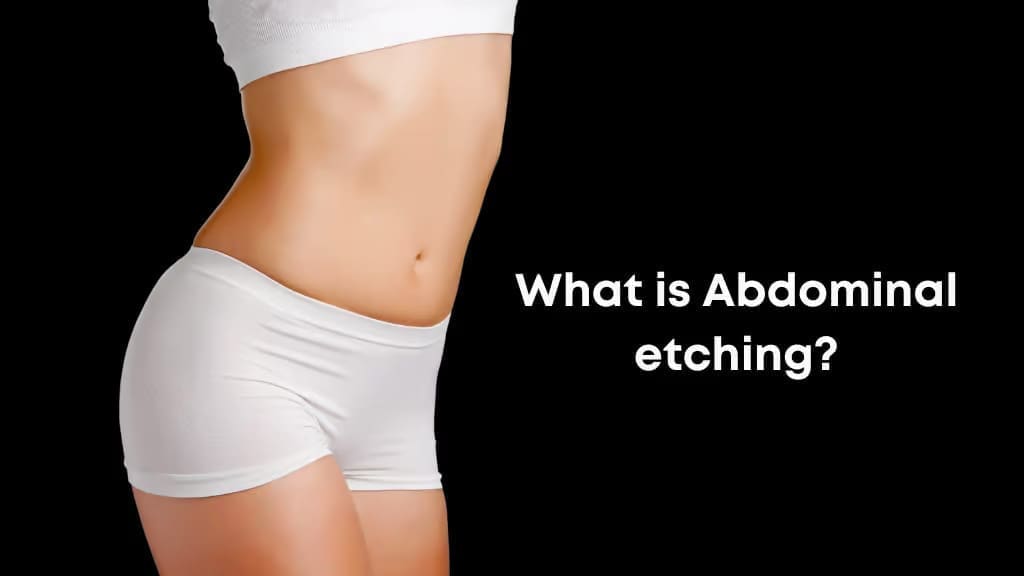 What is Abdominal Etching?