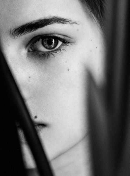 Lower Blepharoplasty